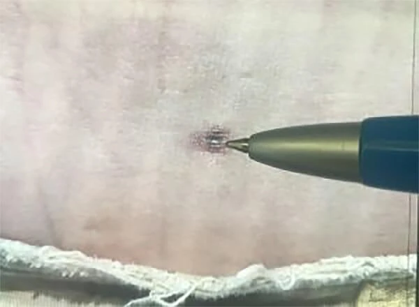 second image