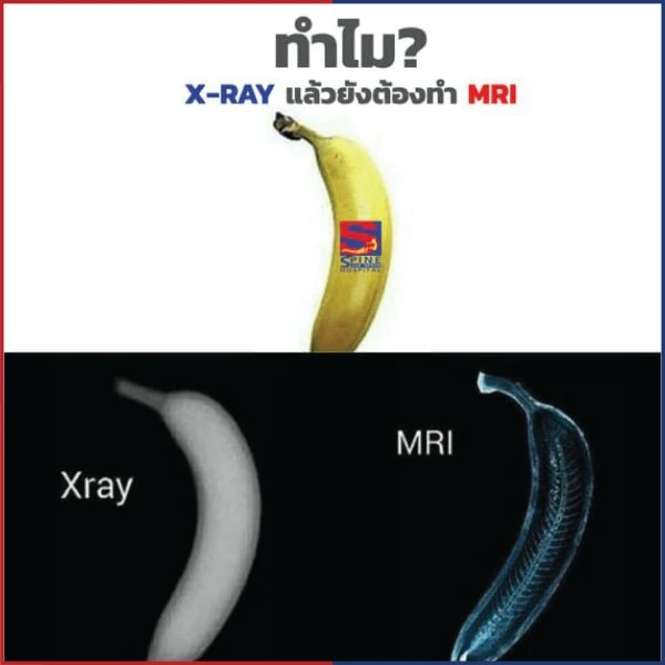 second image