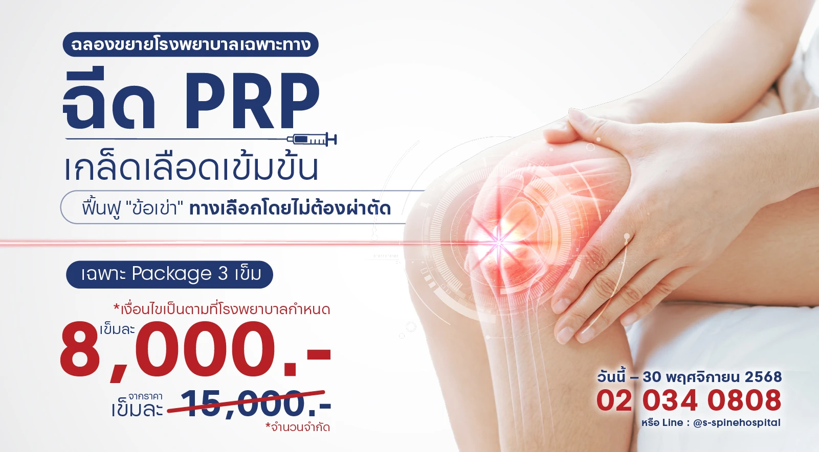 ฉีด PRP ราคาเข็มละ 8,000 บาท ที่โรงพยาบาลเฉพาะทางด้านกระดูกสันหลังและข้อ เรากล้าให้คุณ