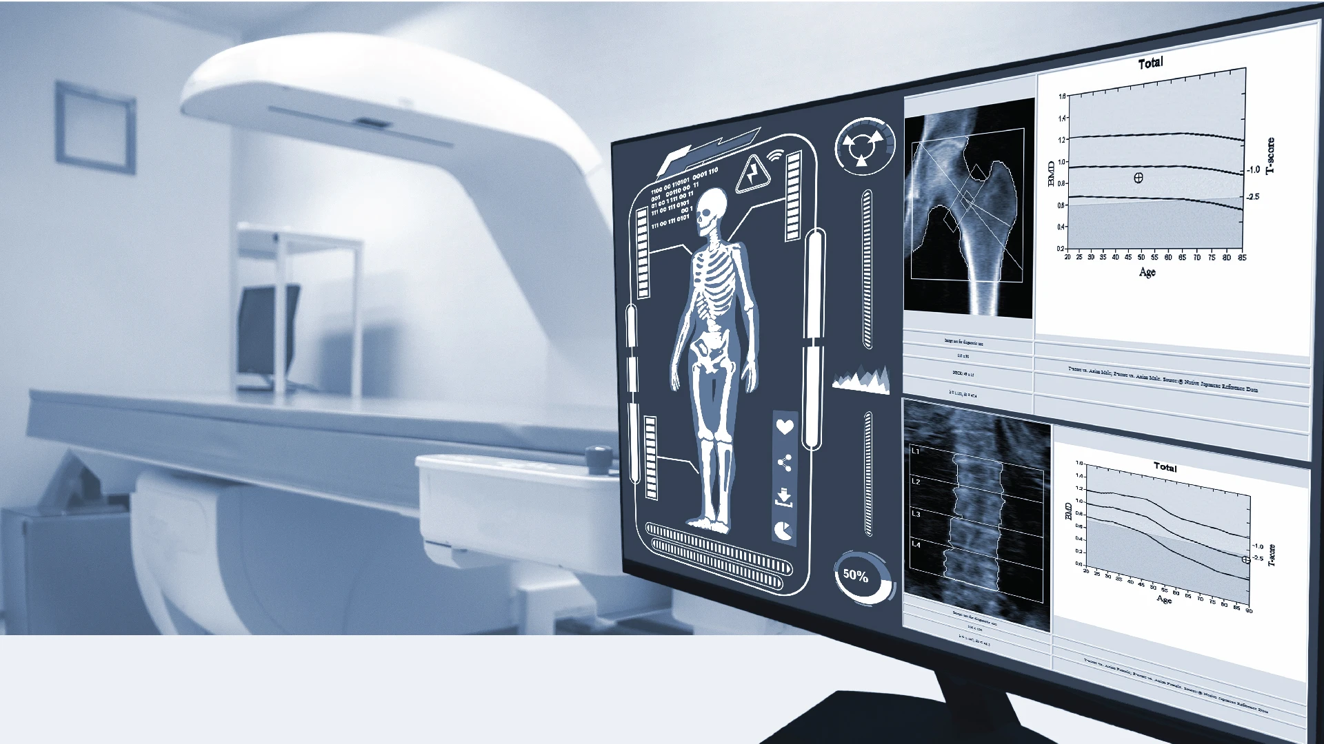 ตรวจวัดความหนาแน่นกระดูก (Bone Mineral Density : BMD)