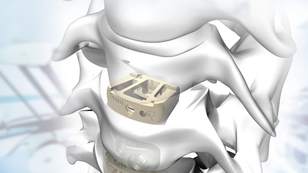second image