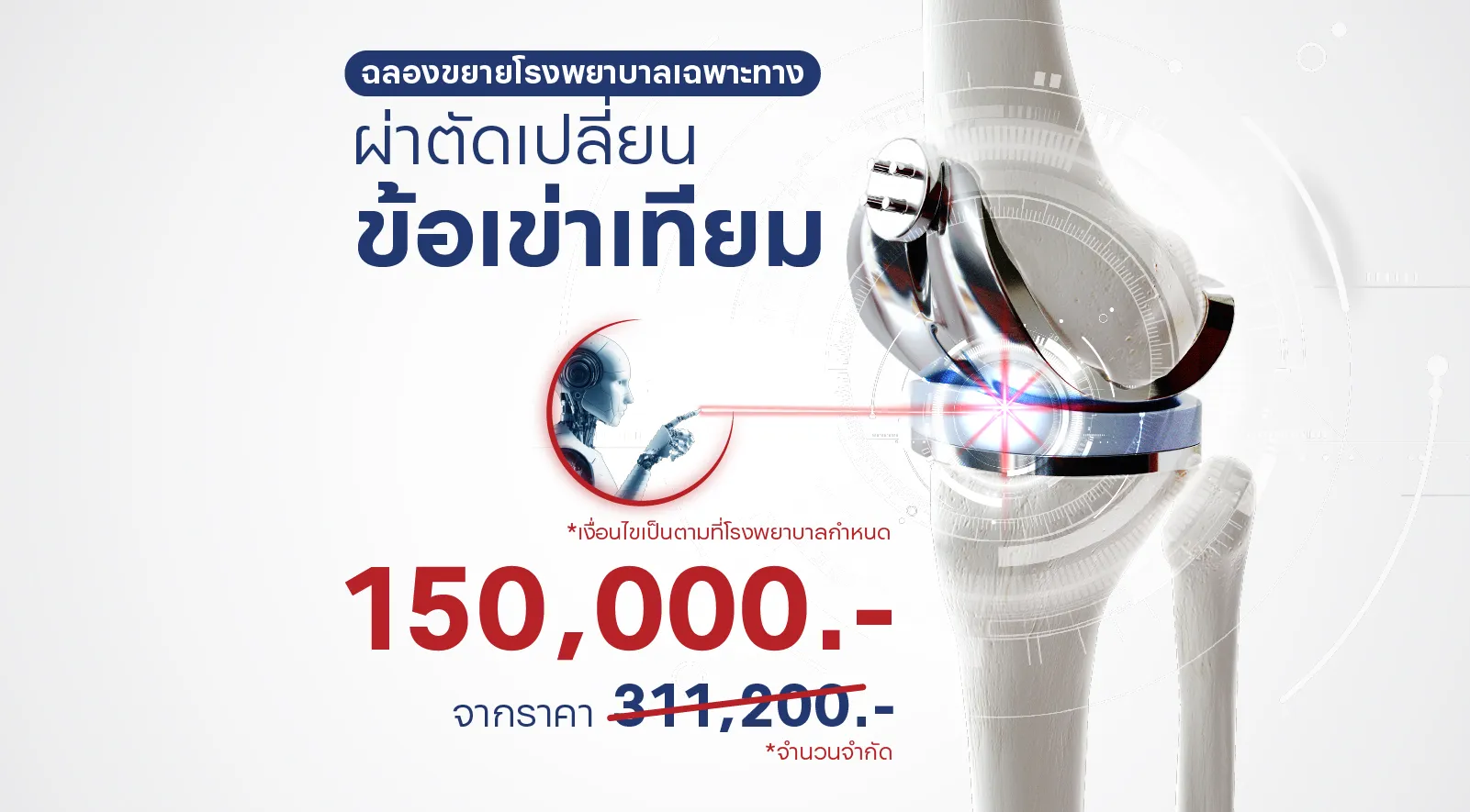 ผ่าตัดเปลี่ยนข้อเข่าเทียม ราคาสุดพิเศษ! 7 วัน 7 โปรโมชันแห่งปี ที่พลาดไม่ได้