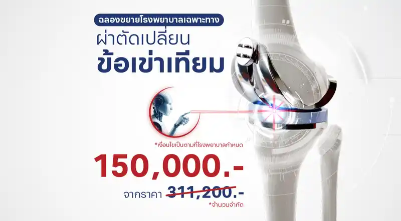 ผ่าตัดเปลี่ยนข้อเข่าเทียม ราคาสุดพิเศษ! 7 วัน 7 โปรโมชันแห่งปี ที่พลาดไม่ได้