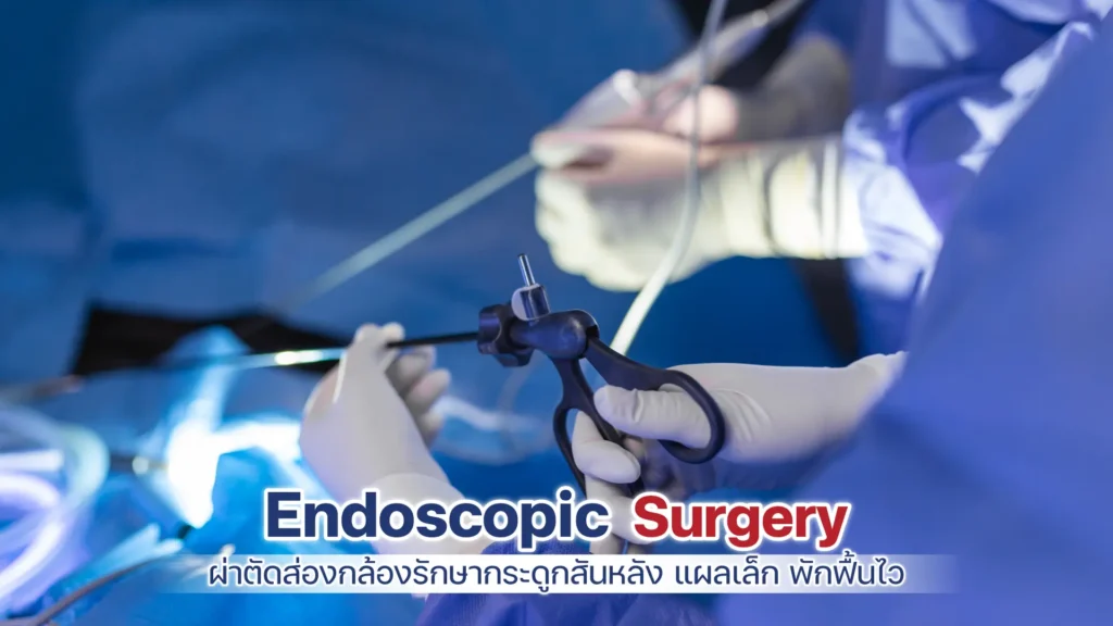 ผ่าตัด Endoscopic Surgery