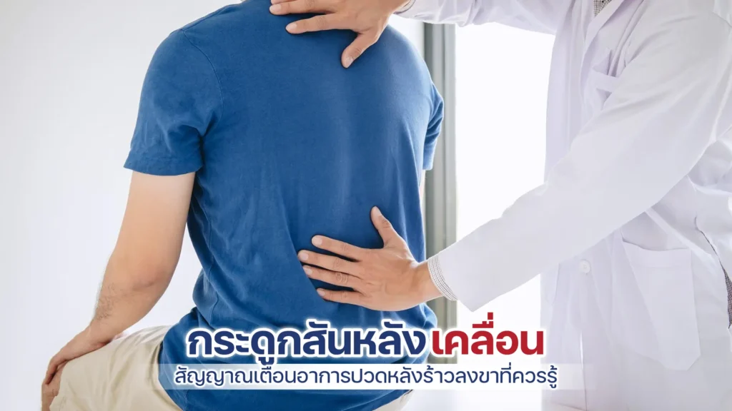 กระดูกสันหลังเคลื่อน